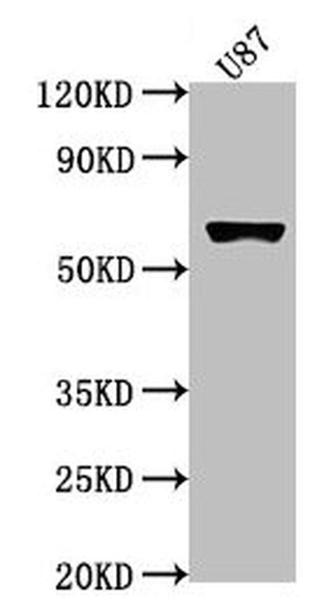 USP17L1 Antibody in Western Blot (WB)