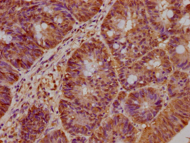 BAAT1 Antibody in Immunohistochemistry (Paraffin) (IHC (P))