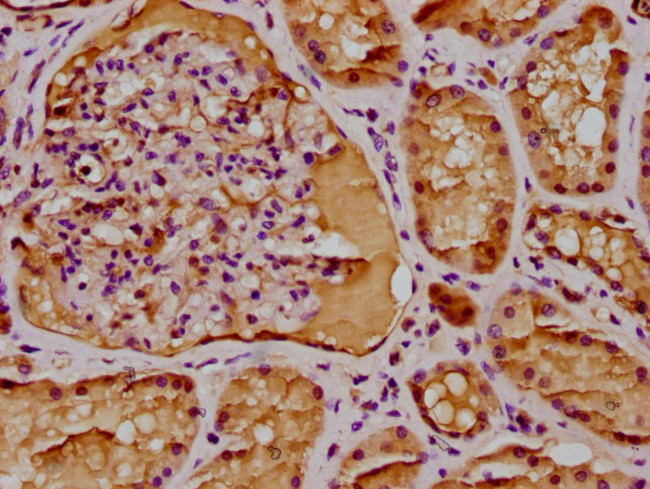 BAAT1 Antibody in Immunohistochemistry (Paraffin) (IHC (P))