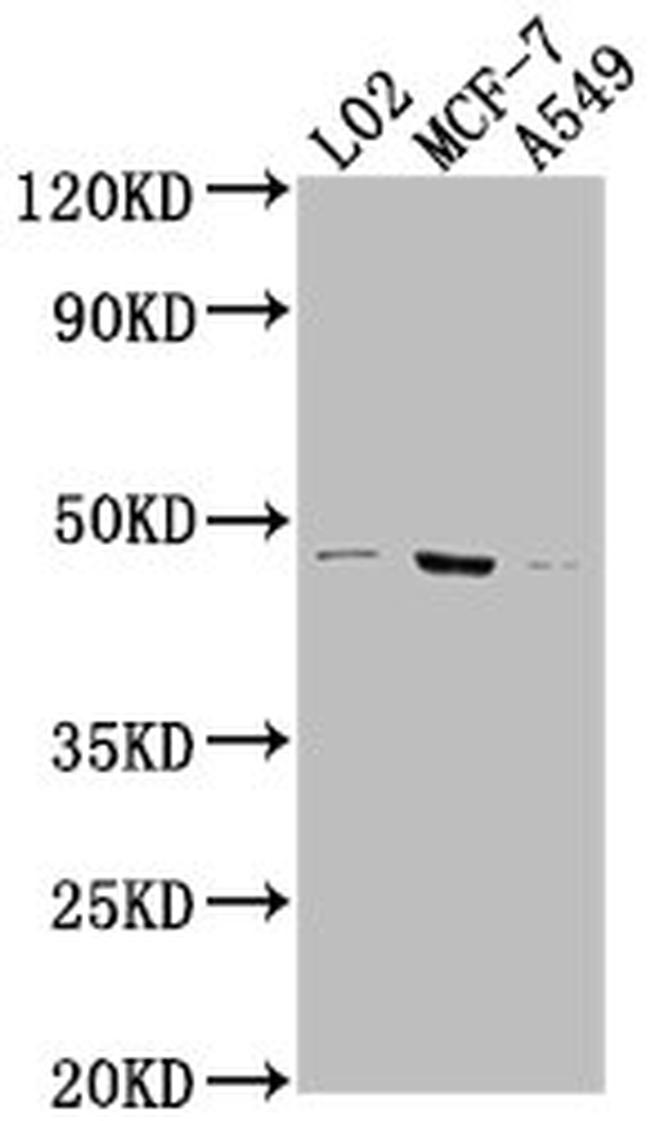 USP17L6P Antibody in Western Blot (WB)