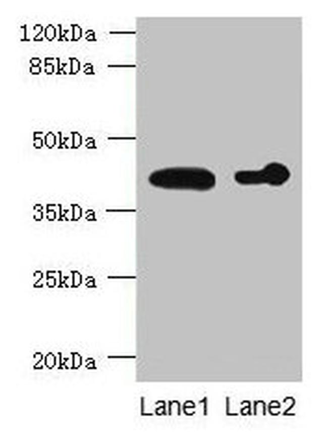 ASPHD2 Antibody in Western Blot (WB)