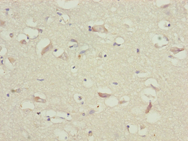 TTLL7 Antibody in Immunohistochemistry (Paraffin) (IHC (P))