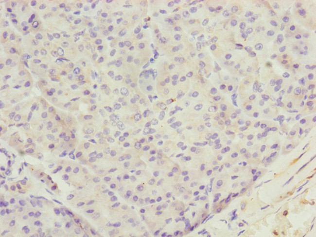 TTLL7 Antibody in Immunohistochemistry (Paraffin) (IHC (P))