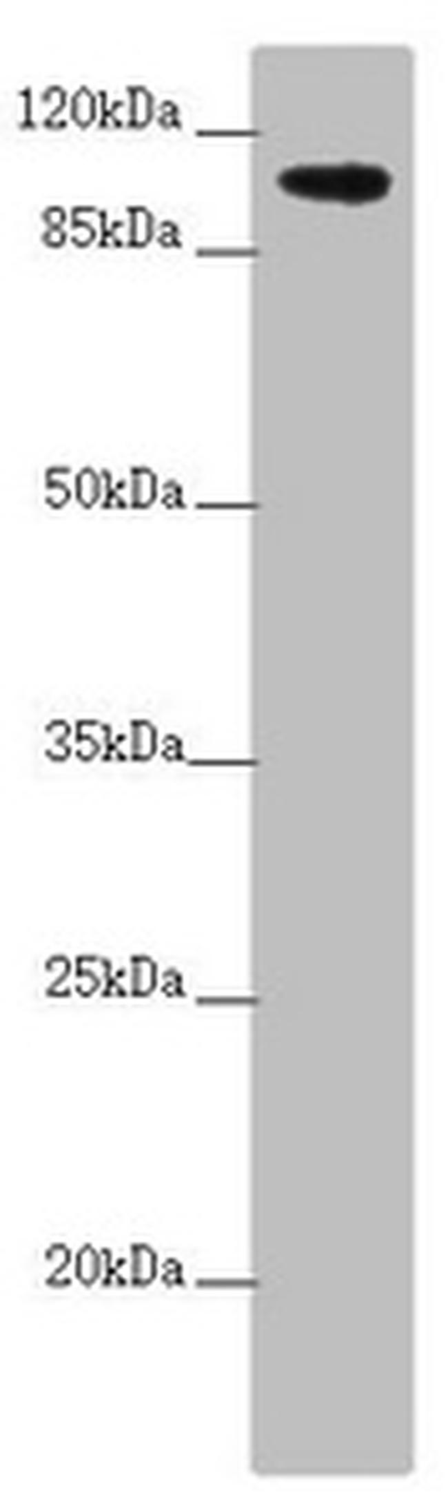 TTLL7 Antibody in Western Blot (WB)