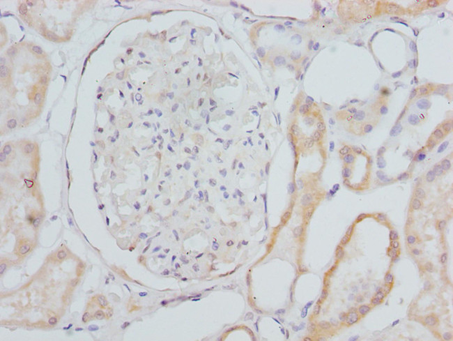 CYP4V2 Antibody in Immunohistochemistry (Paraffin) (IHC (P))