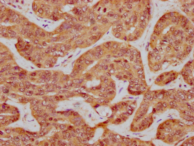 ILDR1 Antibody in Immunohistochemistry (Paraffin) (IHC (P))