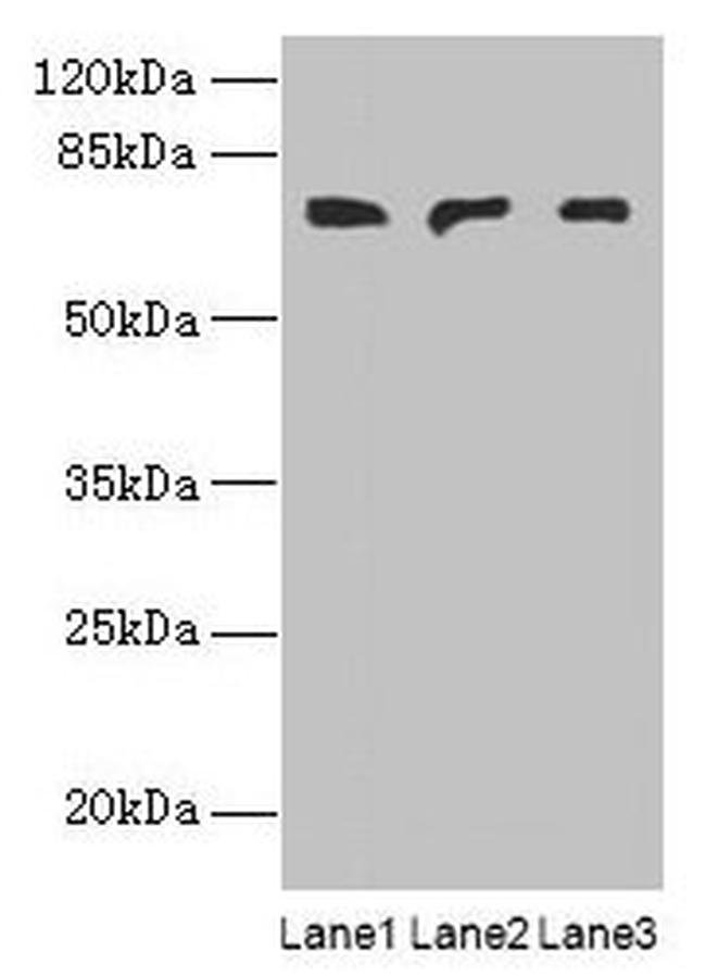 PLCZ1 Antibody in Western Blot (WB)