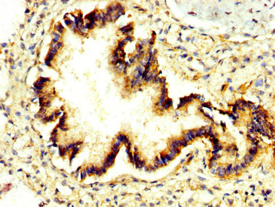 PRUNE Antibody in Immunohistochemistry (Paraffin) (IHC (P))