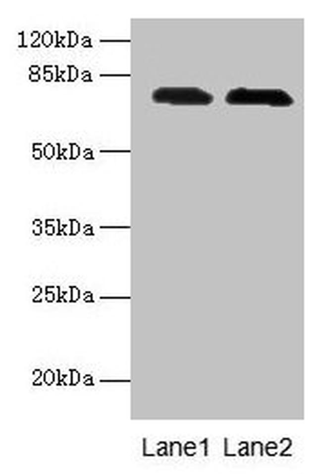 GALNT7 Antibody in Western Blot (WB)