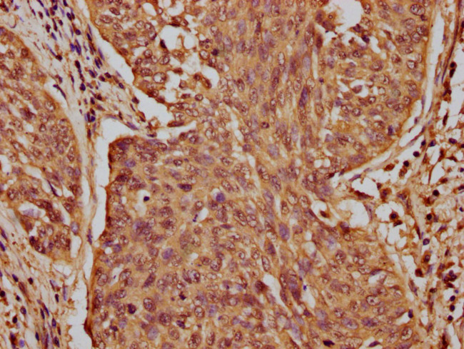 CASZ1 Antibody in Immunohistochemistry (Paraffin) (IHC (P))