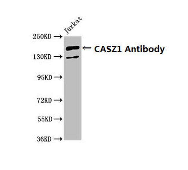 CASZ1 Antibody in Western Blot (WB)