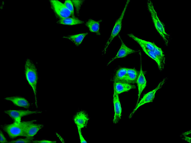 KBTBD6 Antibody in Immunocytochemistry (ICC/IF)