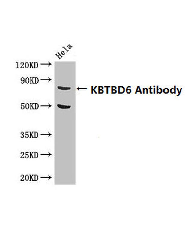 KBTBD6 Antibody in Western Blot (WB)