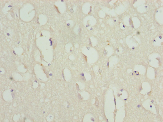 Anillin Antibody in Immunohistochemistry (Paraffin) (IHC (P))