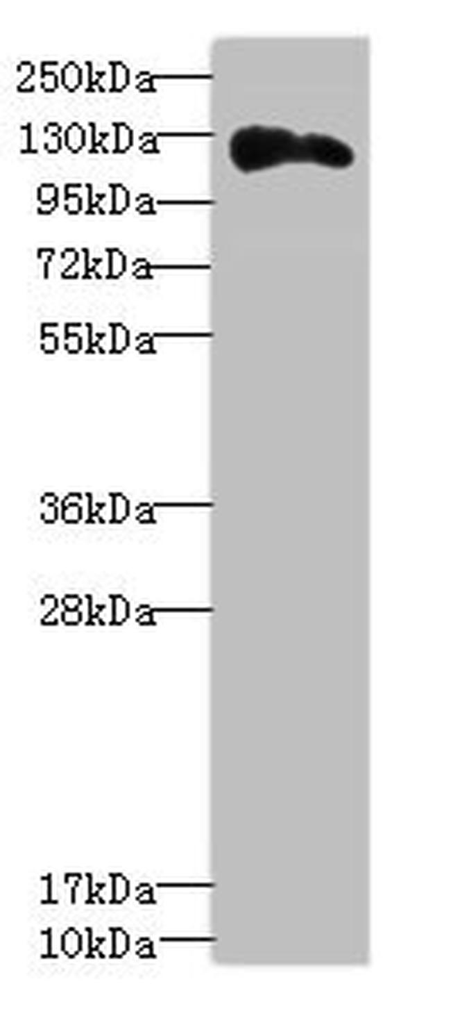 Anillin Antibody in Western Blot (WB)