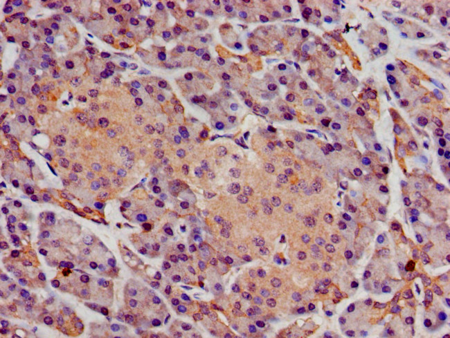 SGMS1 Antibody in Immunohistochemistry (Paraffin) (IHC (P))