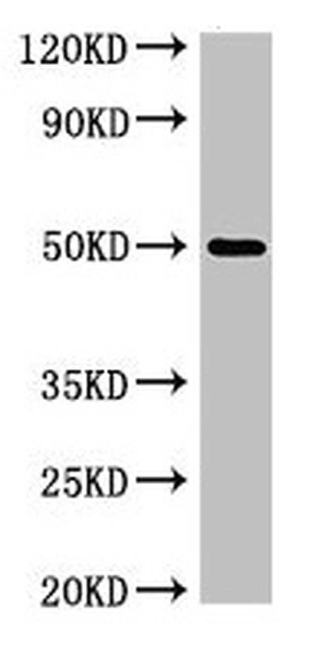SGMS1 Antibody in Western Blot (WB)
