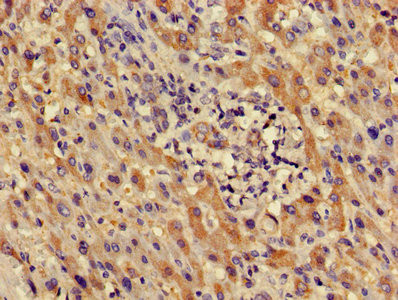 LDHD Antibody in Immunohistochemistry (Paraffin) (IHC (P))