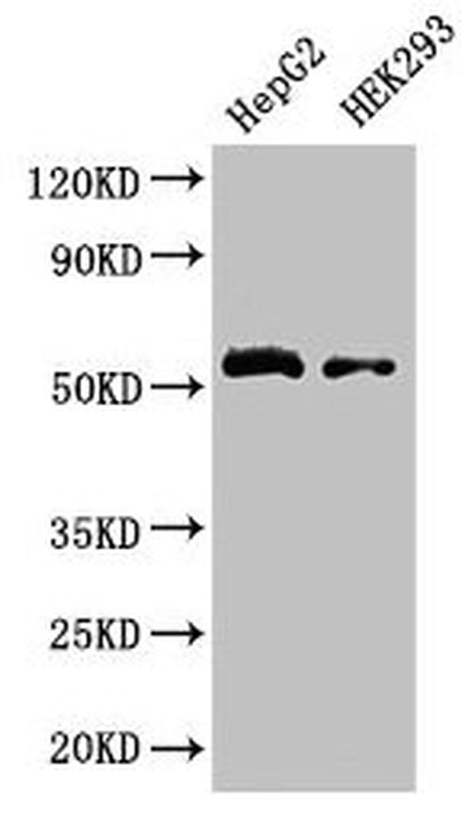 LDHD Antibody in Western Blot (WB)