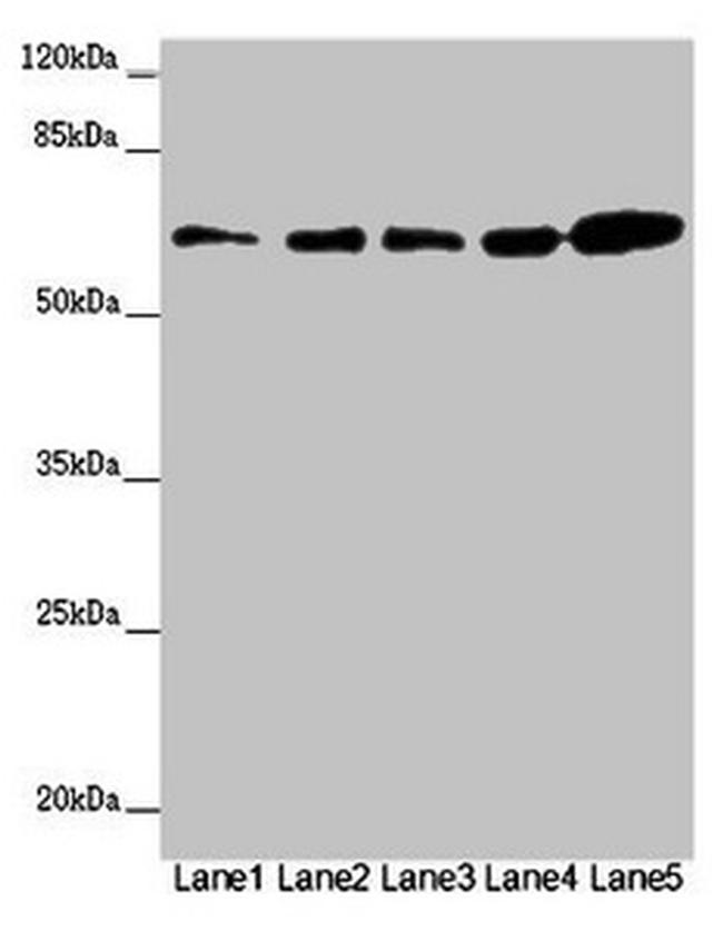 ZBTB46 Antibody in Western Blot (WB)