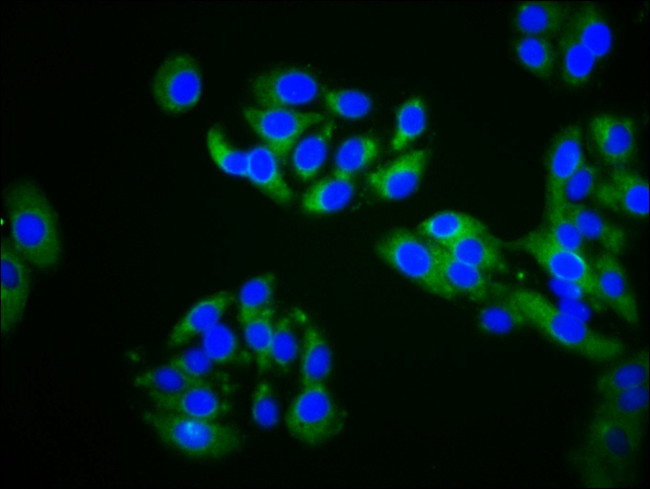 ZDHHC14 Antibody in Immunocytochemistry (ICC/IF)