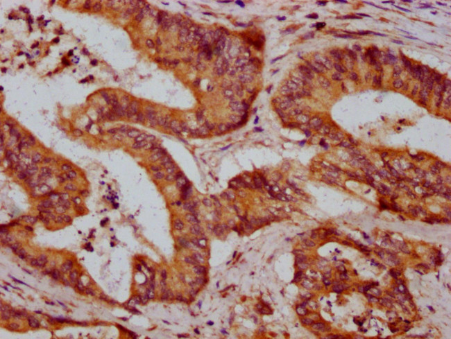 ZDHHC14 Antibody in Immunohistochemistry (Paraffin) (IHC (P))