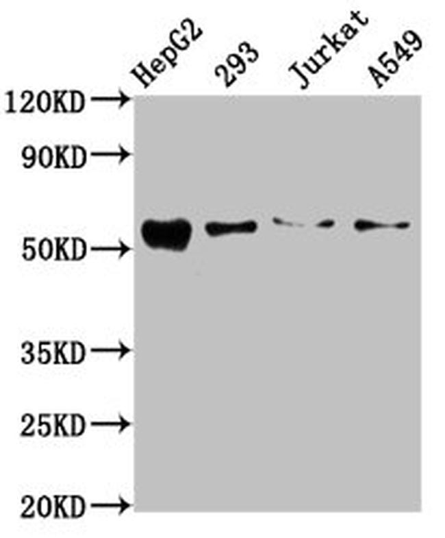 ZDHHC14 Antibody in Western Blot (WB)