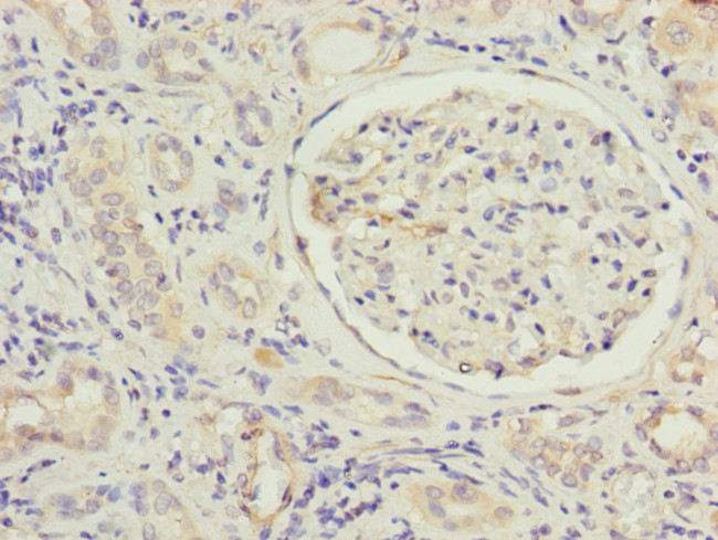 MFN1 Antibody in Immunohistochemistry (Paraffin) (IHC (P))