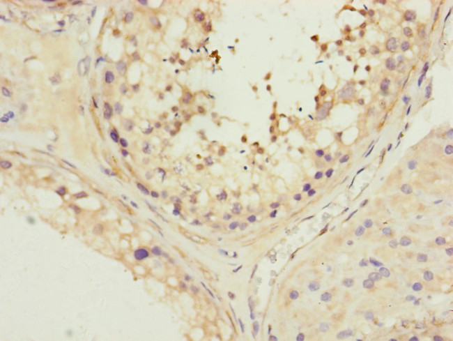 MFN1 Antibody in Immunohistochemistry (Paraffin) (IHC (P))