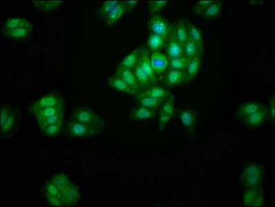 LACE1 Antibody in Immunocytochemistry (ICC/IF)