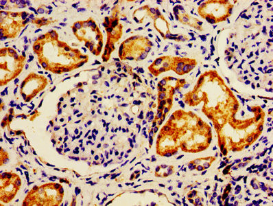 LACE1 Antibody in Immunohistochemistry (Paraffin) (IHC (P))