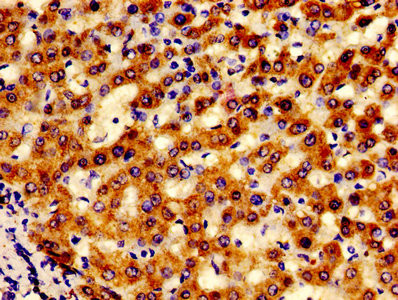 LACE1 Antibody in Immunohistochemistry (Paraffin) (IHC (P))