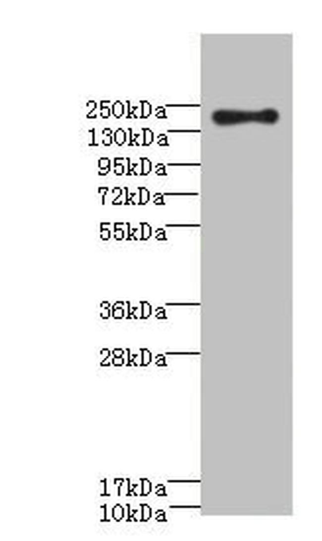 CD35 Antibody in Western Blot (WB)