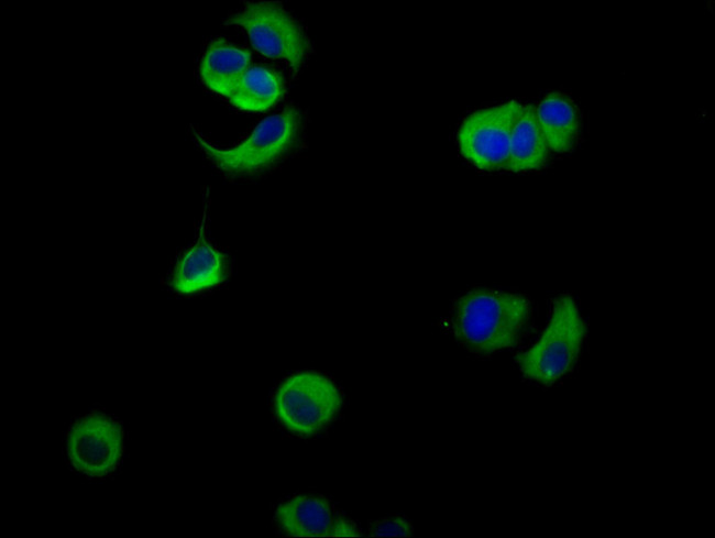 Nectin 4 Antibody in Immunocytochemistry (ICC/IF)