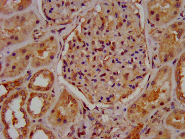 MUC20 Antibody in Immunohistochemistry (Paraffin) (IHC (P))