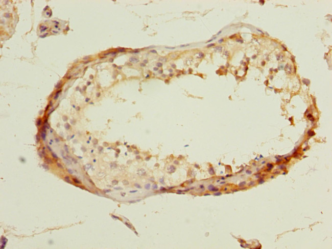 DBF4B Antibody in Immunohistochemistry (Paraffin) (IHC (P))