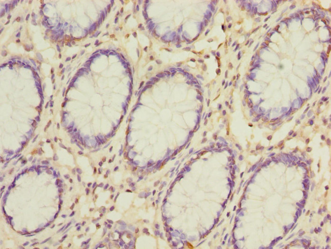 GSDMB Antibody in Immunohistochemistry (Paraffin) (IHC (P))