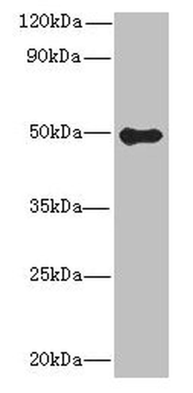 GSDMB Antibody in Western Blot (WB)