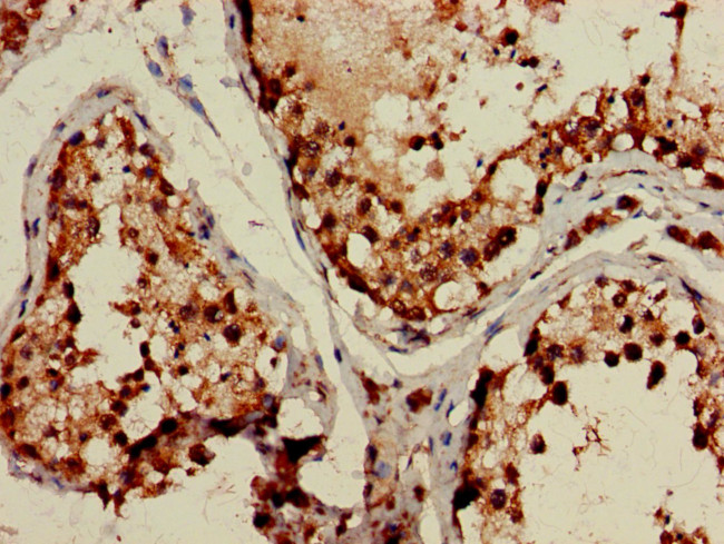 TBC1D15 Antibody in Immunohistochemistry (Paraffin) (IHC (P))