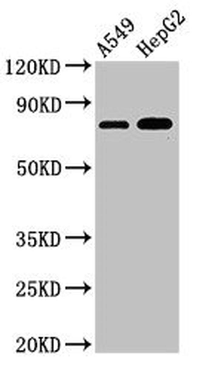 TBC1D15 Antibody in Western Blot (WB)