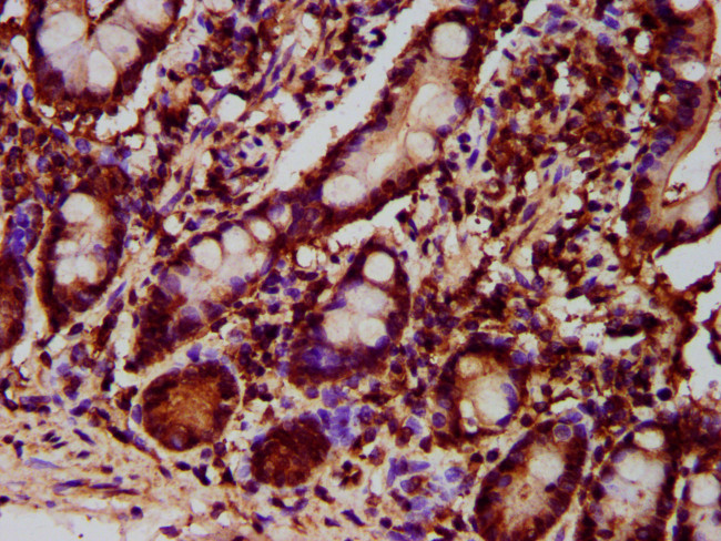 GPT2 Antibody in Immunohistochemistry (Paraffin) (IHC (P))