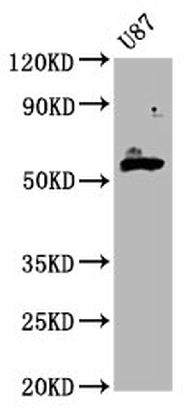 GPT2 Antibody in Western Blot (WB)