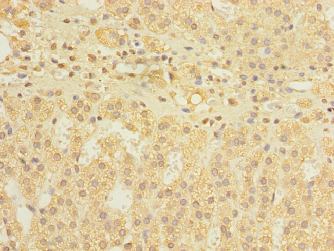 DIS3L Antibody in Immunohistochemistry (Paraffin) (IHC (P))