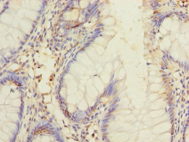 DIS3L Antibody in Immunohistochemistry (Paraffin) (IHC (P))