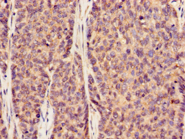 SLC20A1 Antibody in Immunohistochemistry (Paraffin) (IHC (P))