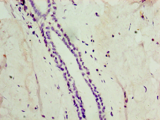 ATG4C Antibody in Immunohistochemistry (Paraffin) (IHC (P))