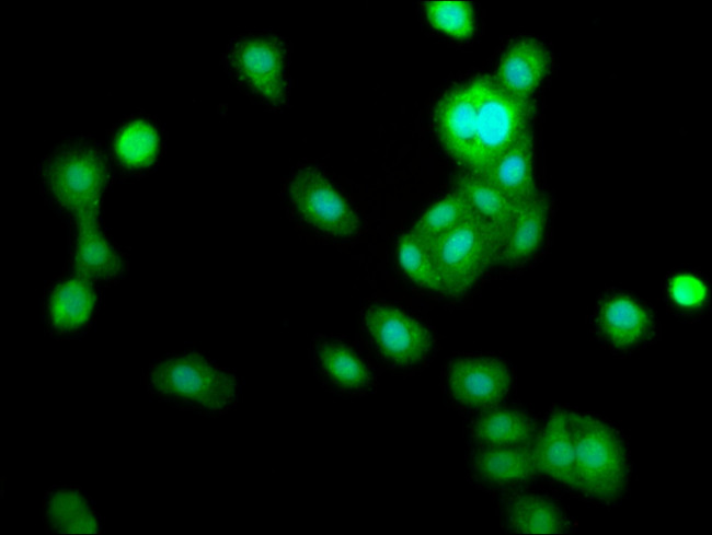TRIB1 Antibody in Immunocytochemistry (ICC/IF)