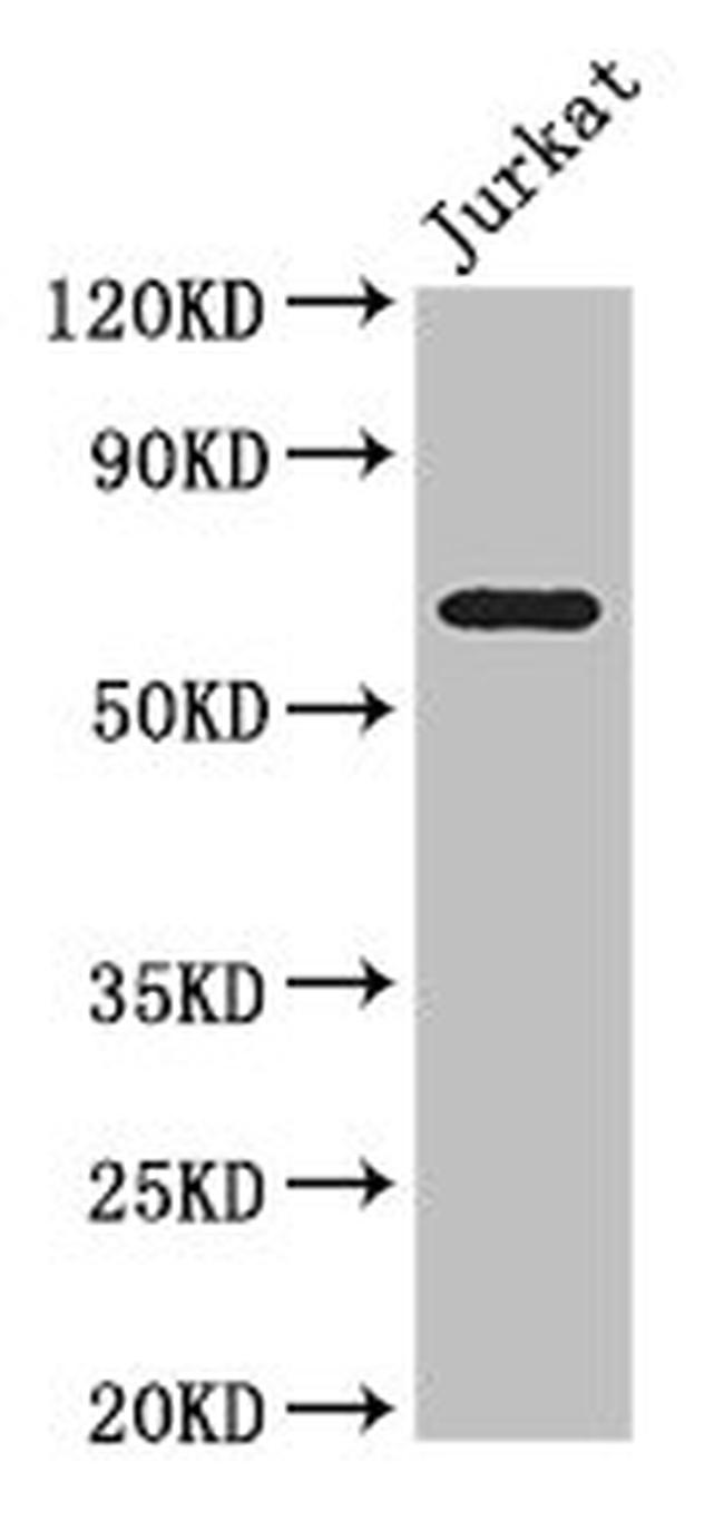 SLC38A9 Antibody in Western Blot (WB)