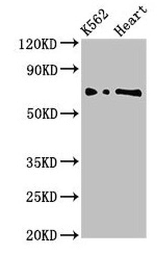 L3MBTL2 Antibody in Western Blot (WB)