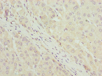 LLCFC1 Antibody in Immunohistochemistry (Paraffin) (IHC (P))